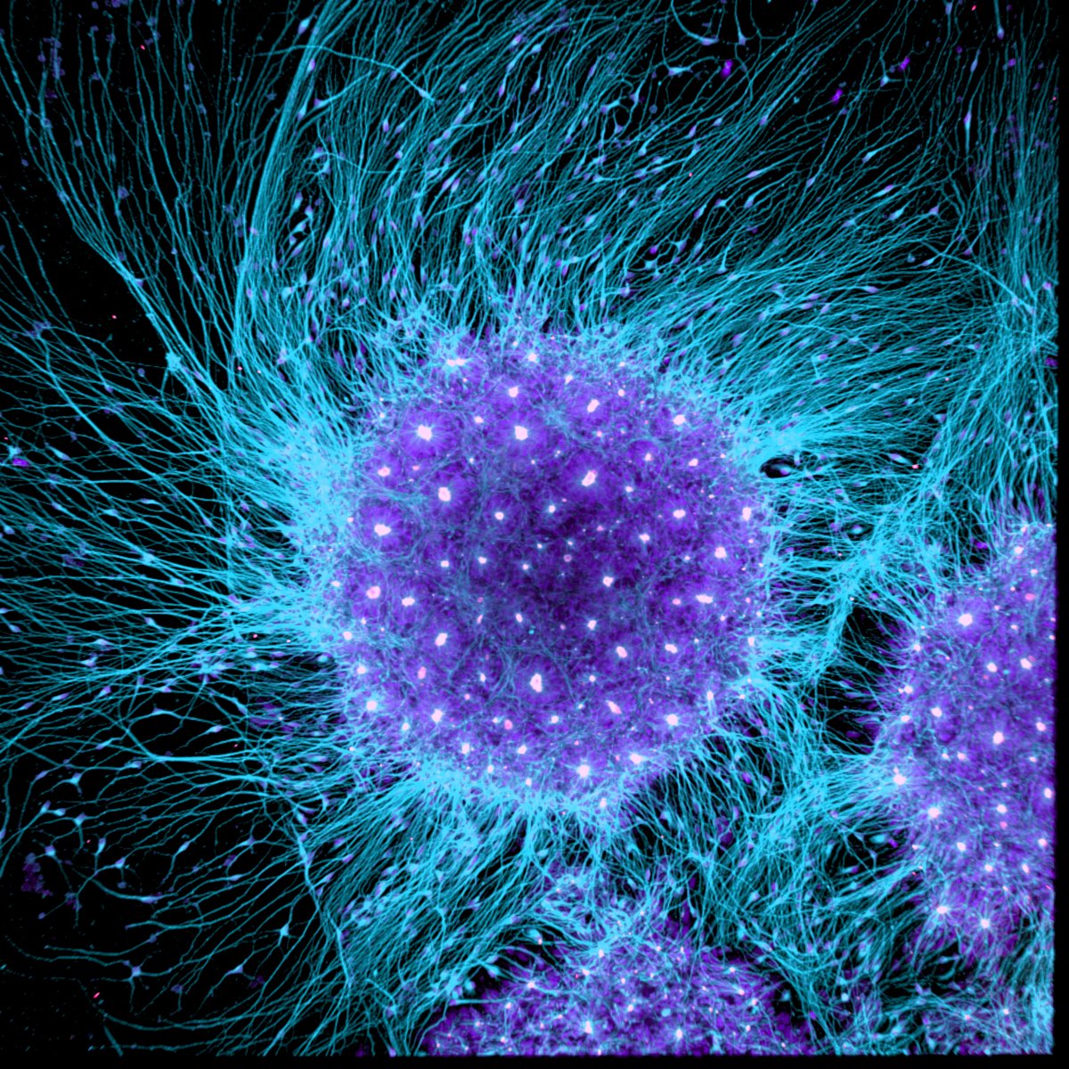 human-brain-cells-differentiated-from-embryonic-stem-cells